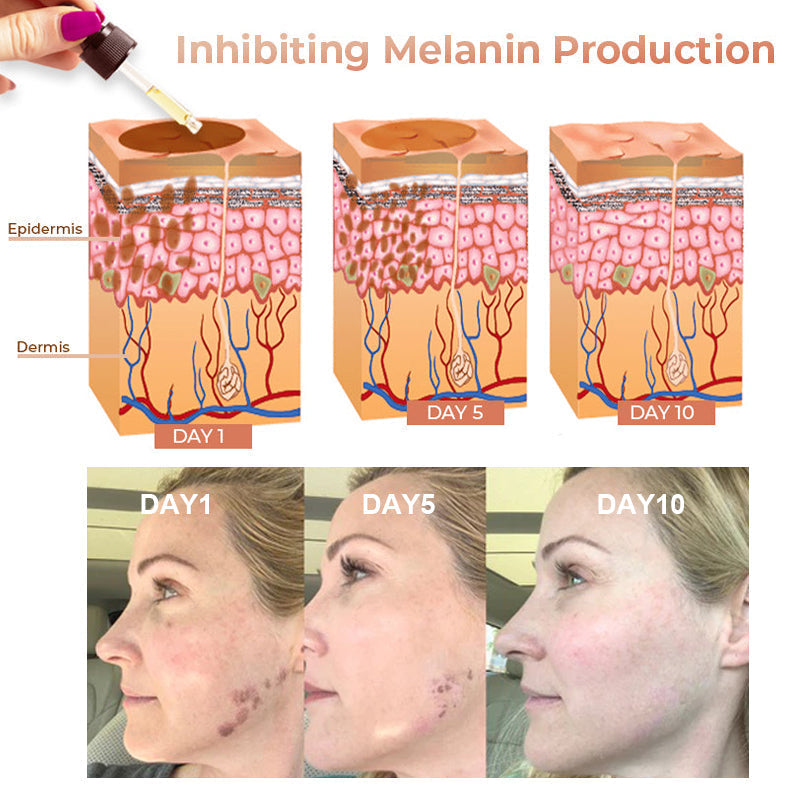 Melanin Correcting Facial Serum – Reduce Pigmentation & Brighten Skin