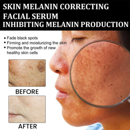 Melanin Correcting Facial Serum – Reduce Pigmentation & Brighten Skin